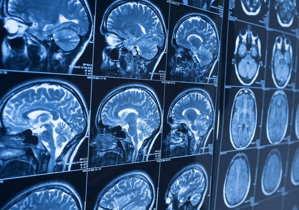 thumbnail of X-Ray Imaging